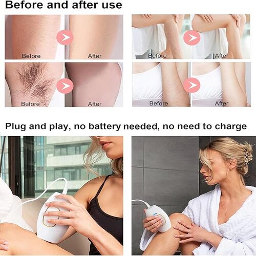 Laser Permanent Hair Removal Painless IPL Hair Remover Device with 5 Energy Levels